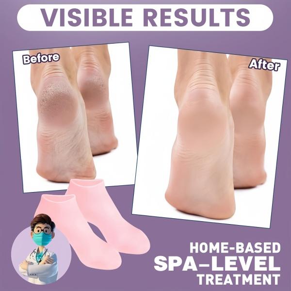 2PCS Silicone Moisturizing Socks, Silicone Pedicure Socks, Silicone Socks for Women, Women's Spa Pedicure Socks for Repairing Dry Feet,Anti Slip Aloe Socks,Cracked Heels and Softening Rough Skin